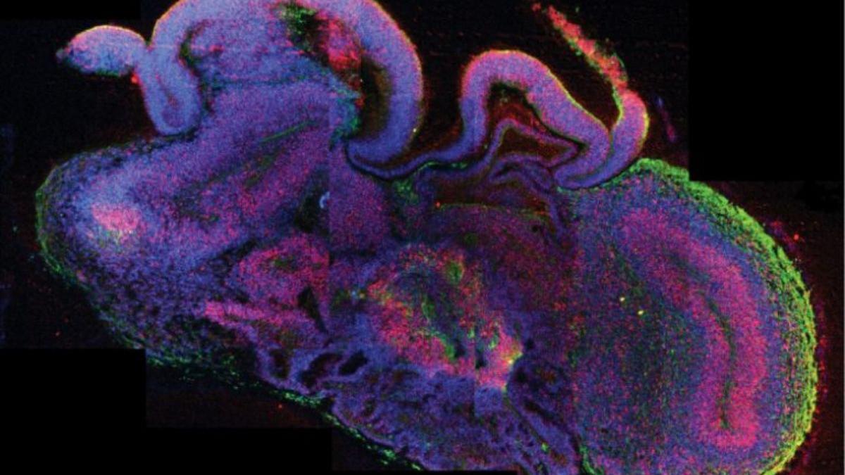 El rápido desarrollo en el campo de los organoides cerebrales abre una gran incógnita sobre sus posibilidades de adquirir consciencia.