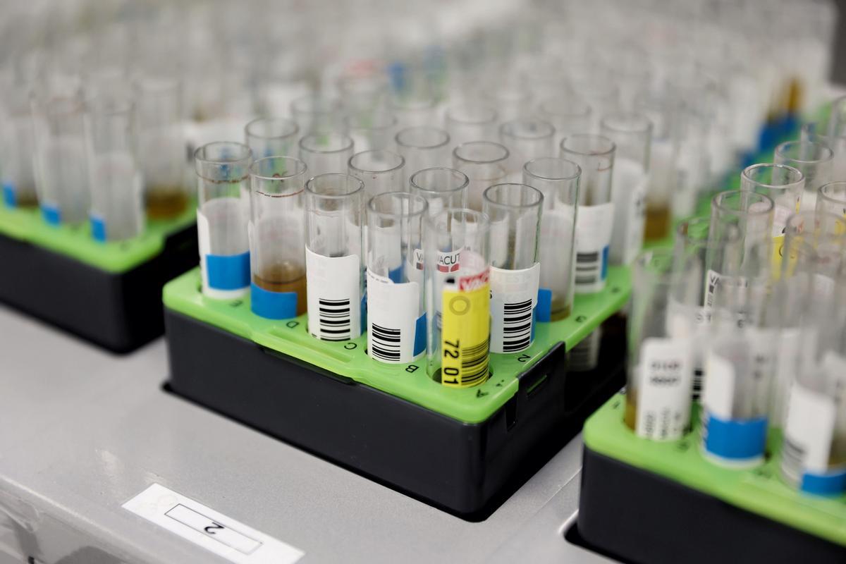 Dossier - Tests PCR pour la variole du singe.