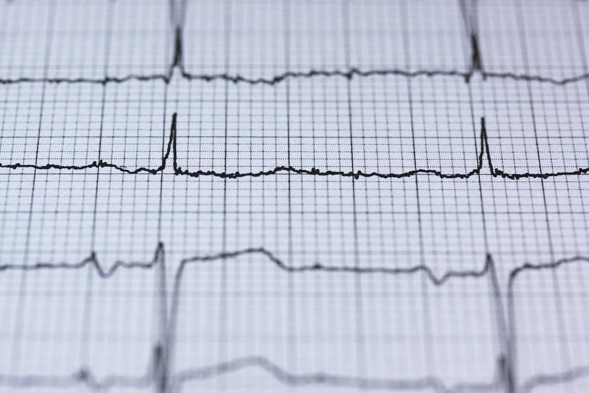 Toute personne pratiquant un sport doit-elle subir un électrocardiogramme préalable ?