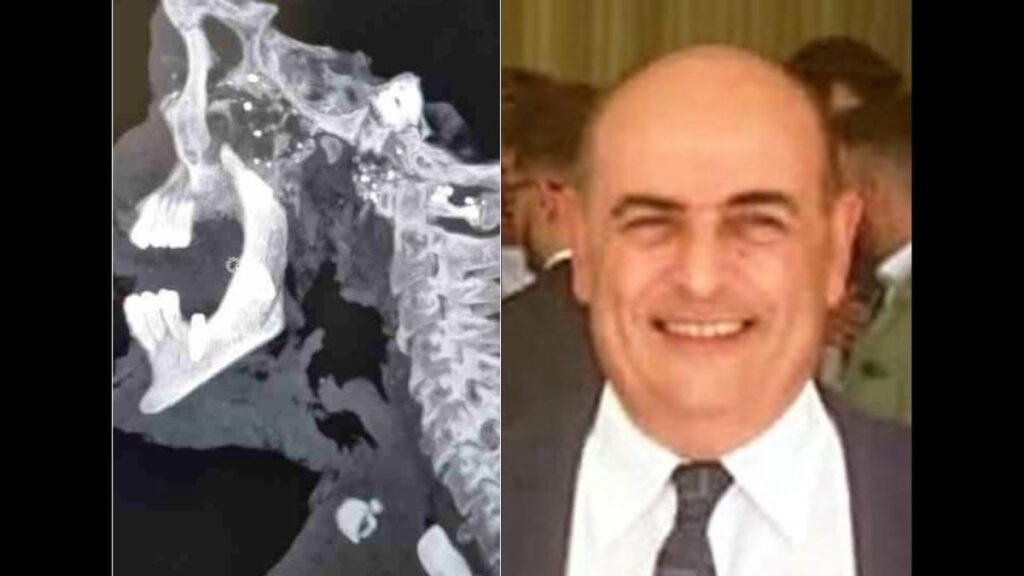 Imagen del bodyTAC realizado al cadáver de Juan Miguel Isla, el empresario asesinado en Manzanares (Ciudad Real).