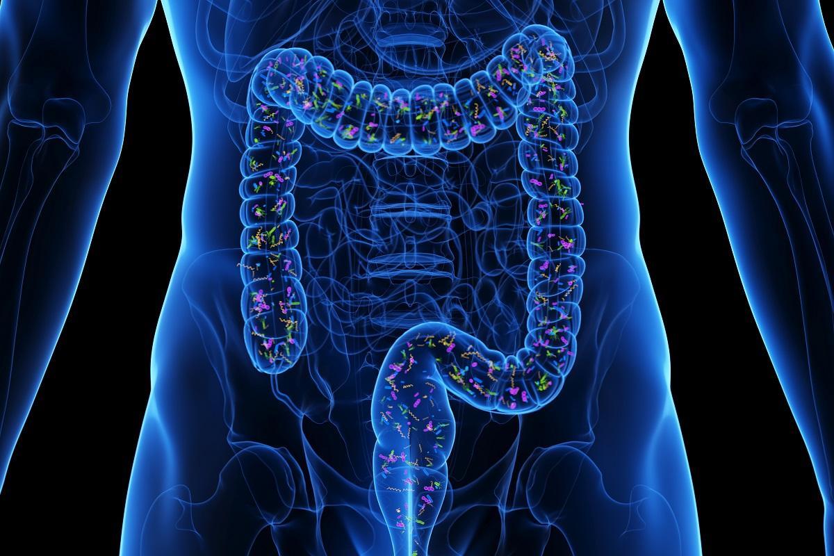 Un surdiagnostic de SIBO se produit-il?