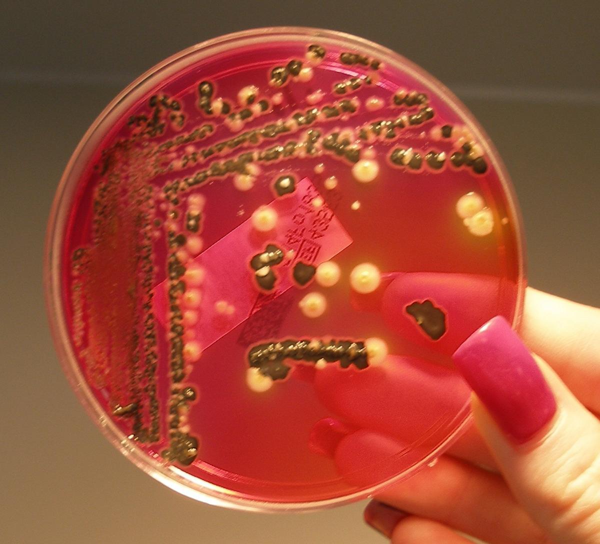 Bactéries de Salmonella poussant à l'agar