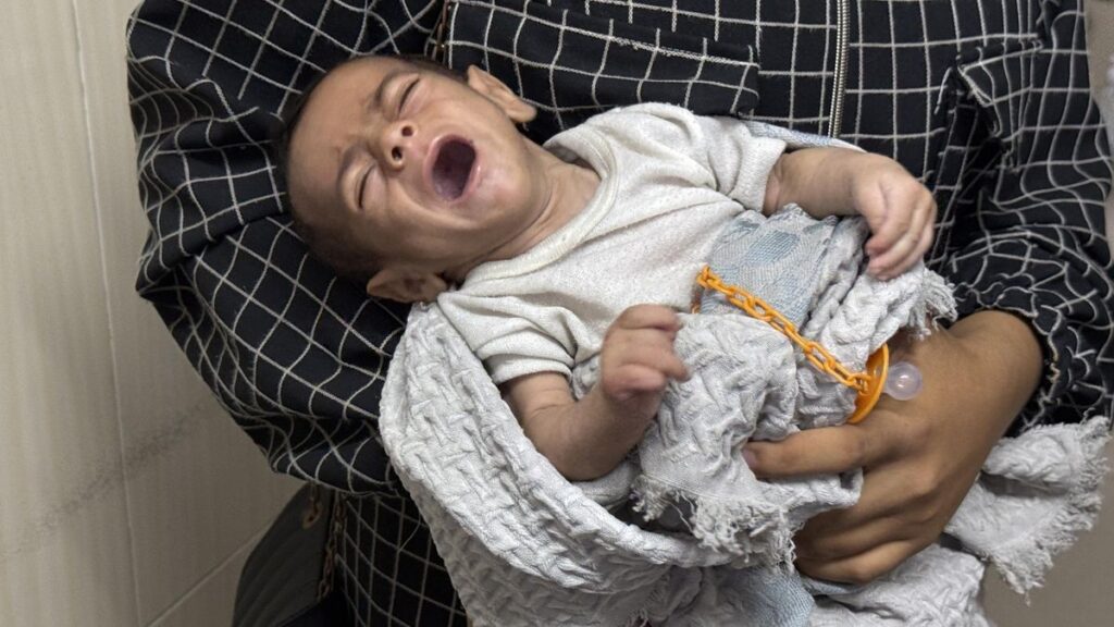 Han muerto más gazatíes por desnutrición en lo que va de 2025 que en los dos años previos
