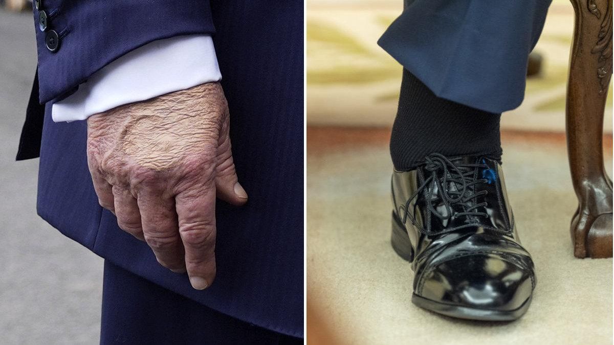Detalle de una mano y un tobillo de Donald Trump, en sendas fotografías tomadas el martes y el miércoles de esta semana en la Casa Blanca.
