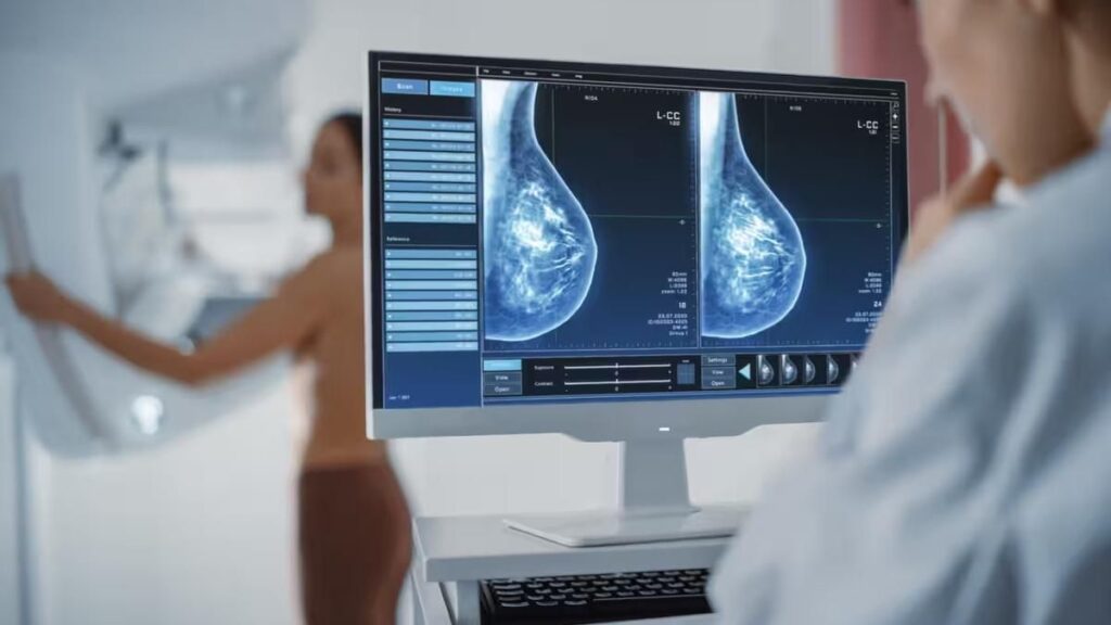 La IA ayuda a mejorar los tratamientos contra el cáncer