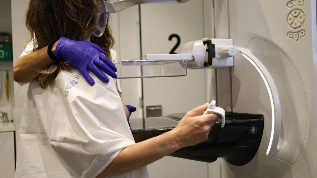 Una mujer se realiza una mamografía para la detección del cáncer de mama