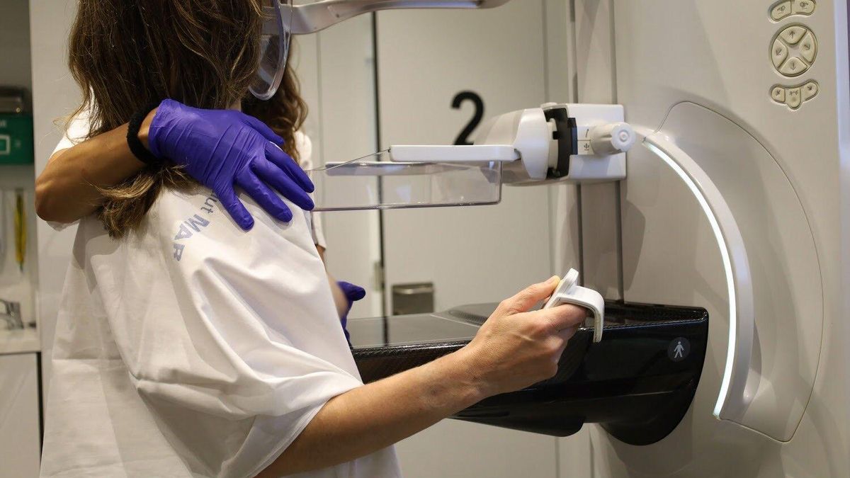 Una mujer se realiza una mamografía para la detección del cáncer de mama