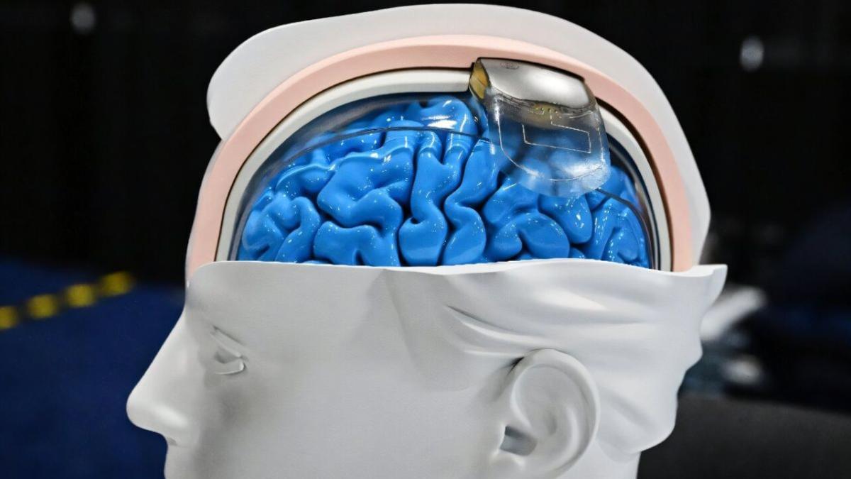 ¿Son los implantes cerebrales la tecnología que cambiará definitivamente nuestra realidad?
